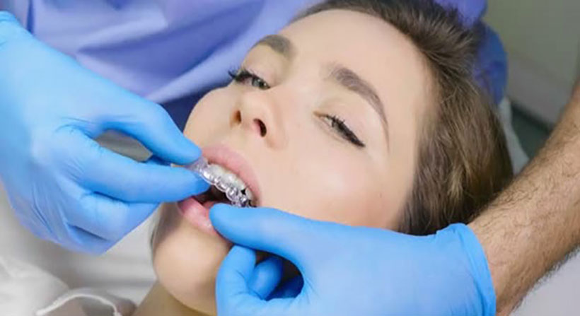 What is Invisalign?