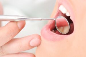 Caring for Your Smile