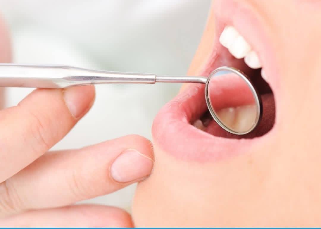 Caring for Your Smile