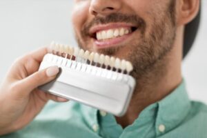 Are Veneers Permanent?