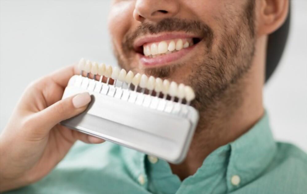 Are Veneers Permanent?