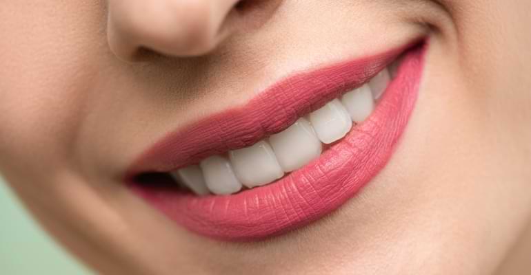 Brighter Smiles: Whitening Your Teeth & Keeping Them White