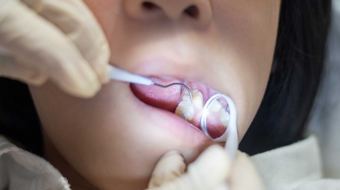 Our Top Tips for a Painless, Stress-Free Root Canal Treatment