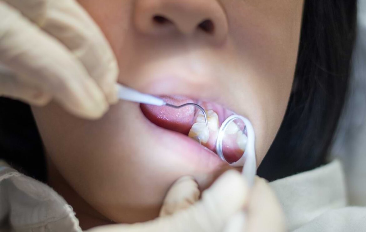 Our Top Tips for a Painless, Stress-Free Root Canal Treatment