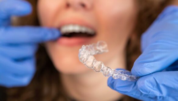 The More You Know: What’s the Difference Between Invisalign & Clear Braces?