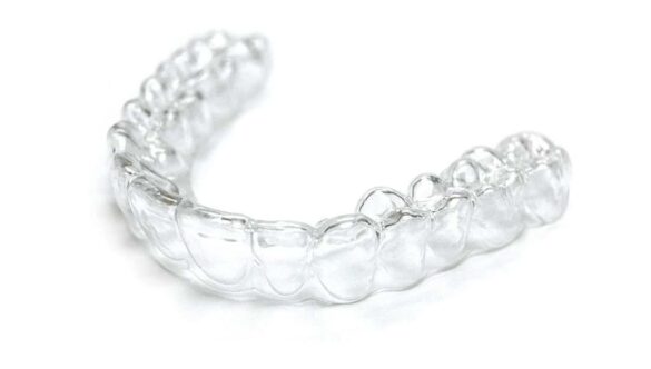 Are You a Good Candidate for a Straighter Smile With Clear Aligners?
