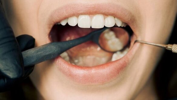 From Catching It Early to Treatment: Your Easy Guide to Periodontitis