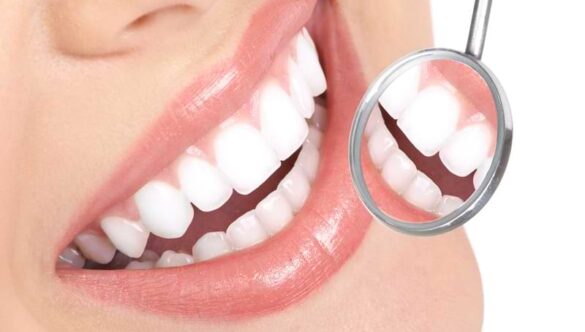 Guarantee a Sparkling Smile At Your Next Big Event With These Teeth Whitening Tips