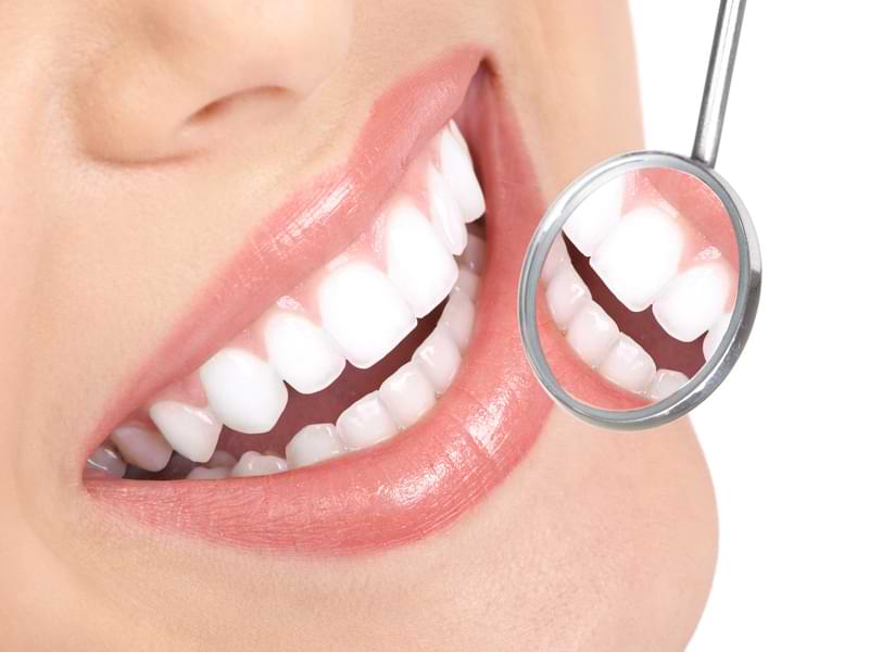 Guarantee a Sparkling Smile At Your Next Big Event With These Teeth Whitening Tips