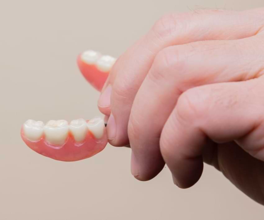 The Importance of Choosing a Good Dentist for Your Dental Bridge