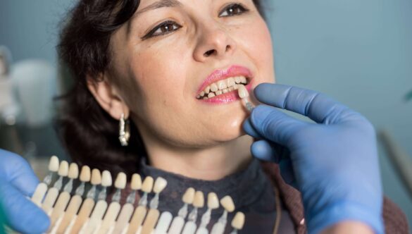 How To Deal With Potential Problems & Complications of Porcelain Veneers