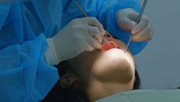 Dental Abscess: Why You Shouldn’t Ignore This Dangerous Infection