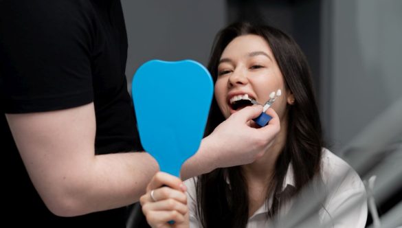 Is It Better to Get Your Teeth Professionally Whitened?