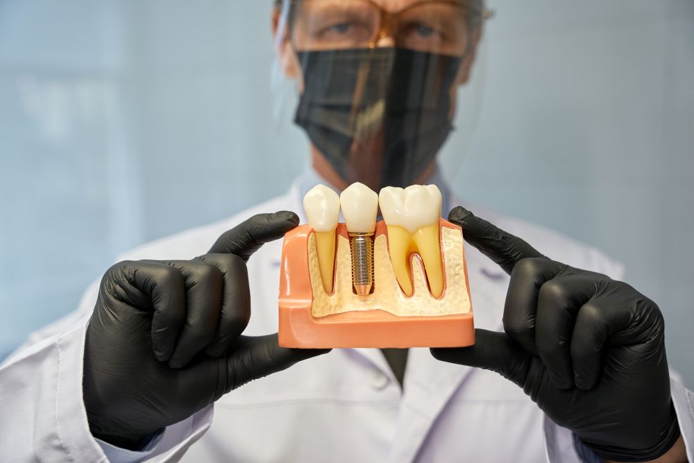 How to Choose the Right Dental Implant Option in Berwick